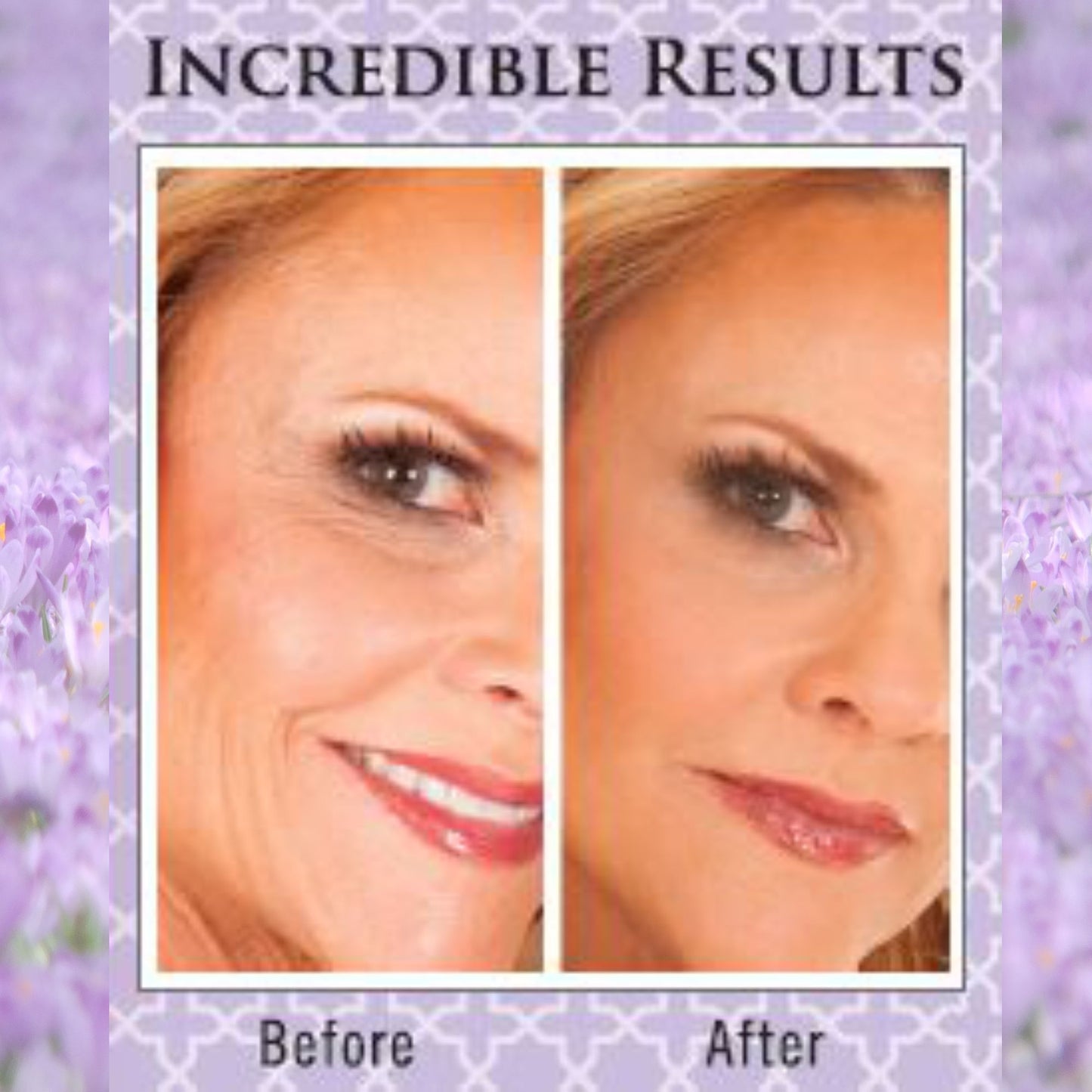 Ancient Secret 24/7 Anti-Aging Lift Crème with Stem Cell Activator, 24 K Gold, Peptides.